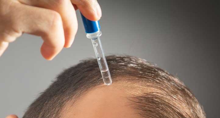 Rosemary Oil vs Minoxidil